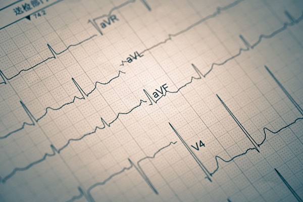 Image: The AI model can predict health risks, including early death, from ECGs (Photo courtesy of Adobe Stock)